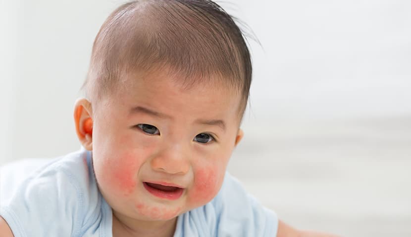 儿童护肤品激素、抗感染类药物测试